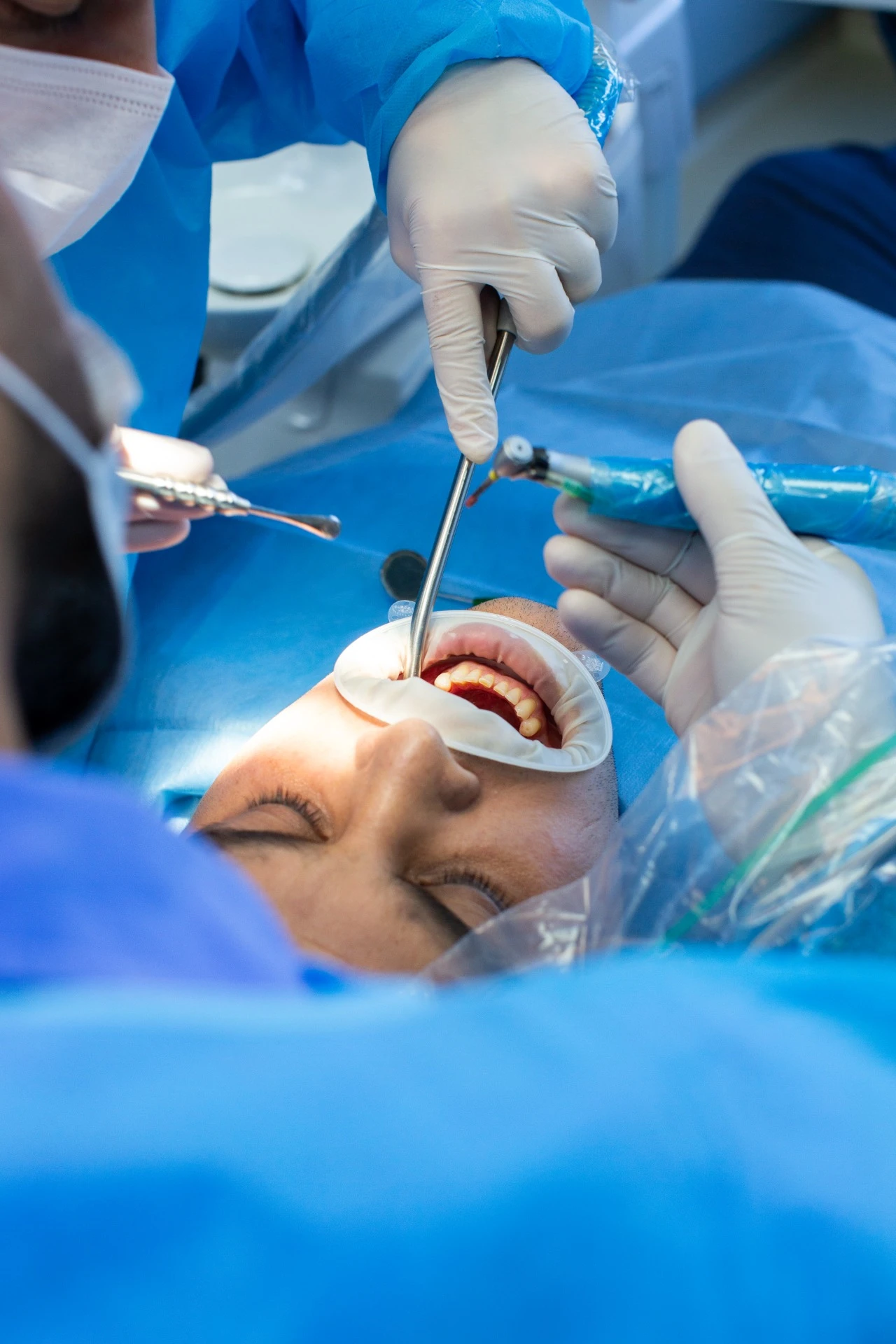 Implantología y Cirugía oral