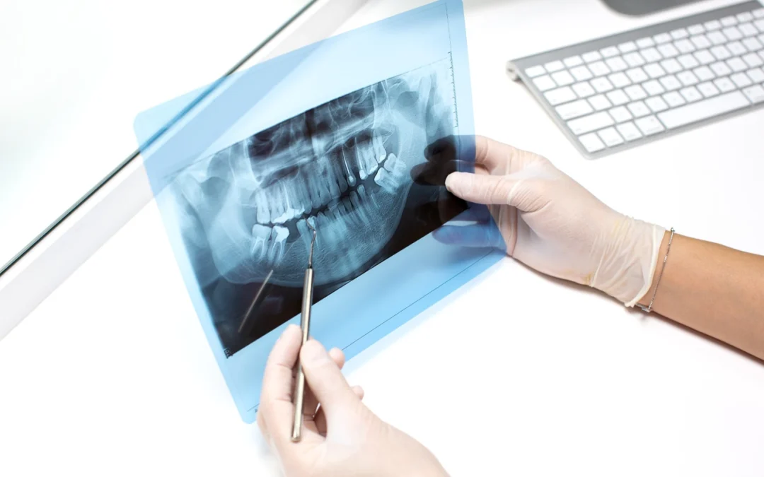 La radiología en odontología