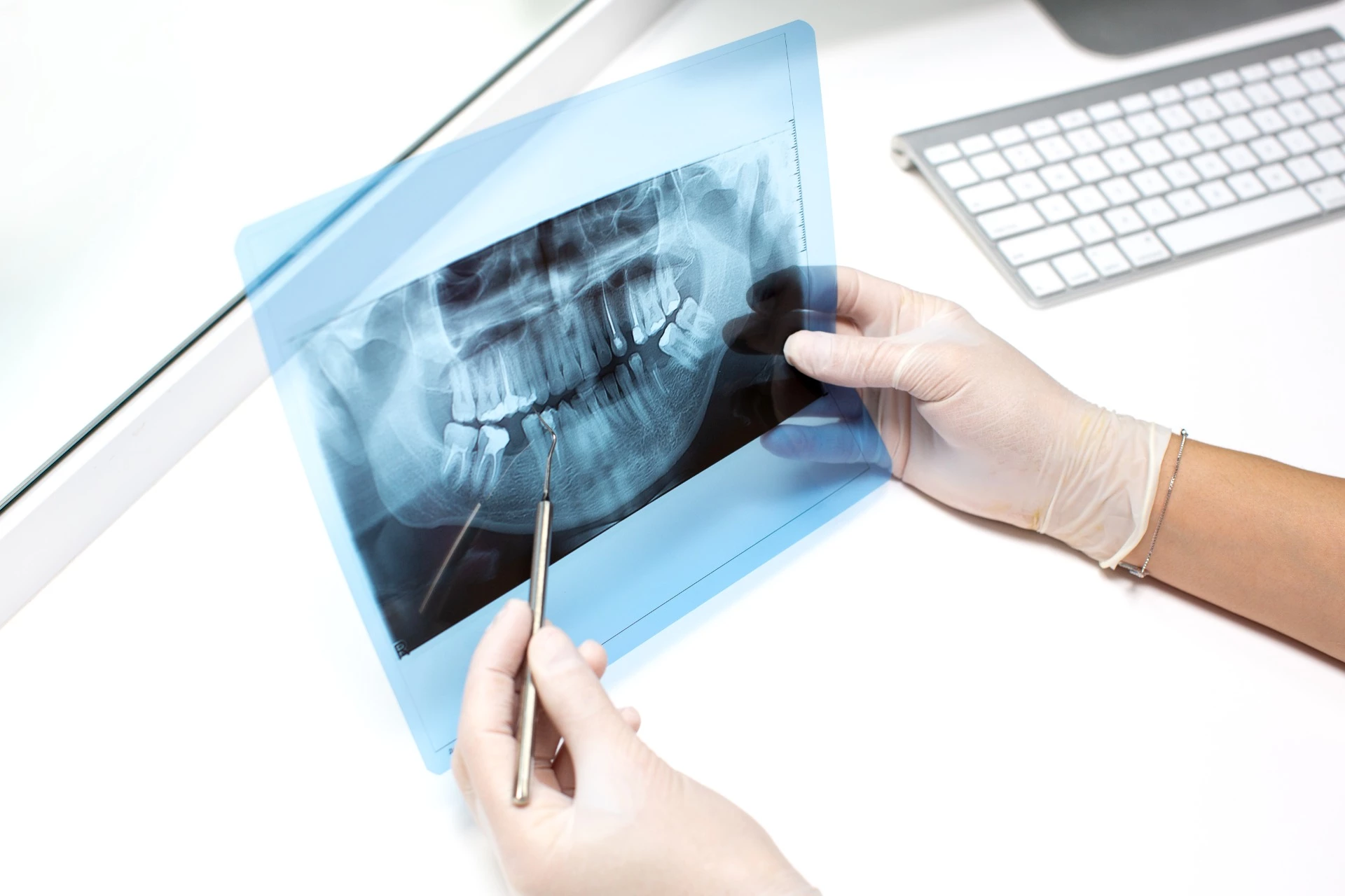 La radiología en odontología